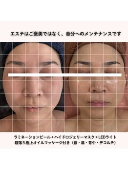 ココロ(COCORO)/おすすめNo.1フェイシャルメニュ