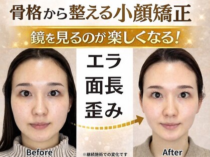 ザ リフト カドモリ 鹿児島 霧島(The Lift KADOMORI)の写真