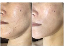 クレビア(CREBIA)/