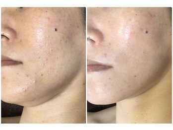 クレビア(CREBIA)/