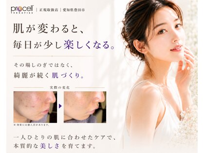 ル シーニュの写真