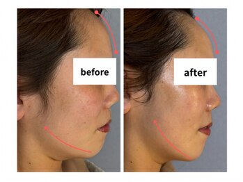 サロン シェリール(Salon Cherir)の写真/人気No.1☆【むくみ、たるみ、ほうれい線改善】頭蓋骨調整90分¥14000→¥8000◇