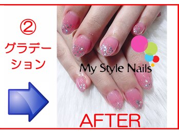 マイ スタイル ネイルズ(My Style Nails)/Before & After