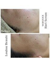 ルルボーテ(Loulou Beaute)/waxxxx