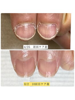 ミモザ(mimosa)/地爪育成コース