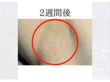 サロンドウルス(salon de ours)/2週間後