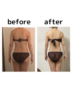 サロンデュヒャーク 志木駅前店(salon du ひゃーく)/ダイエットしたい方集まれ!!