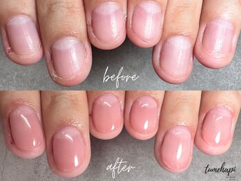 ツメハピ(tumehapi)/深爪ケア ビフォーアフター♪