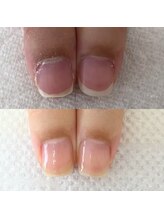 ウェルズユキ(well's yuki)/美爪育成/ネイルケア/ささくれ