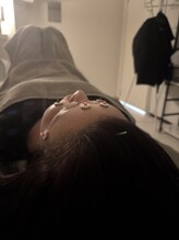 ラフテル鍼灸整骨院/眼精疲労解消は当院の美容鍼◎