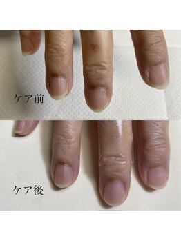 ハンドケア/ネイルケア