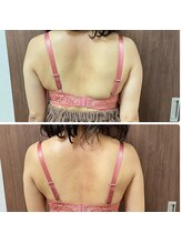 エミニナル(EMININAL)/【バストケア】ビフォーアフター