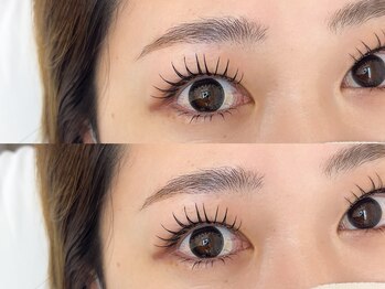 ソア(soa.)/LED上下(Haruka施術)