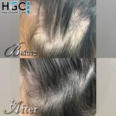 HGCラボ 新宿店
