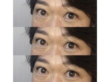 シアミス(SIAMIHS)/シングルエクステ