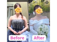 オハナ整骨院(Ohana整骨院)/綺麗な鎖骨が作れます◎