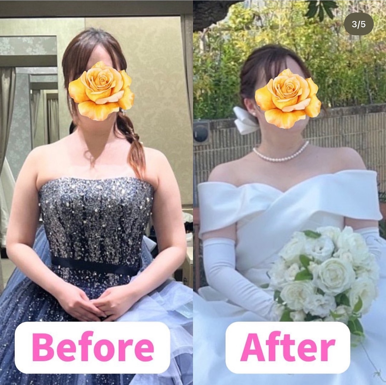 オハナ整骨院(Ohana整骨院)/綺麗な鎖骨が作れます◎