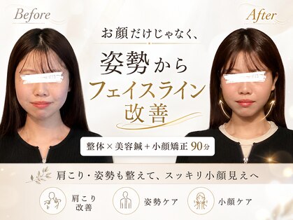 ハリユナイテッド 原宿鍼灸 整体院(HALI UNITED)の写真