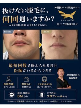 ジェントル 三宮の写真/【完全都度払い】専門の国家資格保有者がいる脱毛サロン☆最適な出力設定でスピーディーに脱毛を♪