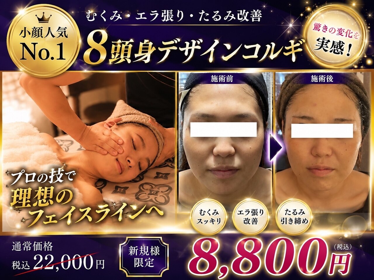 【8月限定】夏のむくみ解消◎8頭身デザイン小顔コルギ 22,000円→8,800円