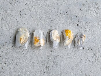 ルフトエーデ(LUFT Ode)/【Art 10】ぷっくり立体