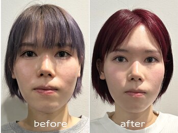 ビー バランス(Be.BALANCE)/【ダイヤモンド小顔矯正】