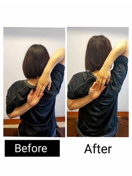 アース エンジェル整体院/ビフォアフ 肩甲骨はがし