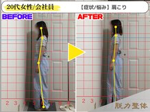 幸せのもり整体院/【20代女性／会社員】Aさん