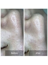 ダリア(Dahlia)/人気No.1メニュー