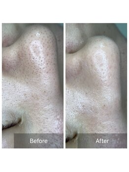 ダリア(Dahlia)/人気No.1メニュー