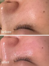 セルベッラ(cerbella)/毛穴もキレイ