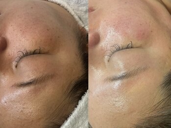 ラニブロウ(Lani brow)/ワントーン明るい肌へ