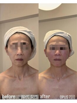 フロル(FLOR)/FLOR 【根本改善専門店】