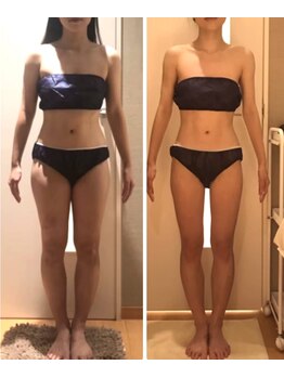 パルティール 恵比寿店(partir)/ムチっとボディをスッキリボディ