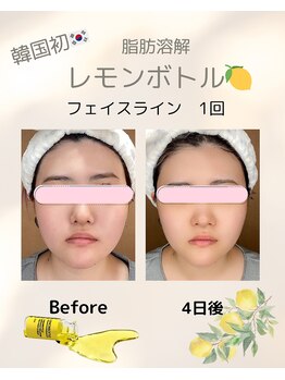 ルーチェ カリーノ(Luce Carino)/話題のレモンボトル