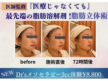 クリニカルエステ/イーズ パークプレイス大分店の雰囲気(《Dr'sメソ》施術72時間後の排泄あとのスッキリ感に感動♪)