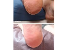 ラシサ(RA shisa)の雰囲気（FOOT／ケアメニュー始めます！ジェルの追加メニューとしても可◎）