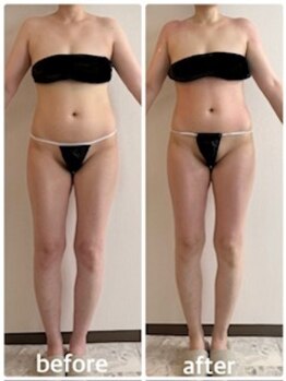 リリラ(ReLilas)の写真/たった1回でも見た目に変化！理想のサイズダウンへ