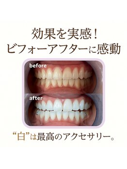 パレ 大阪十三店(Palet)の写真/落ち着いた個室空間でゆったりと♪初めての方にもおすすめ◎歯の黄ばみやくすみをケア！
