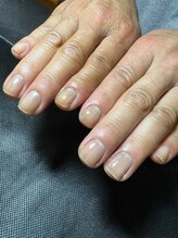 アマランサス(Amaranthus)/爪の色が黒くて悩んでいたお客様