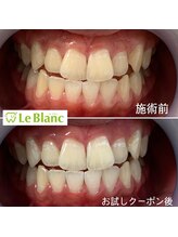 ルブラン 奈良店(Le Blanc)/黄ばみ気になりませんか？