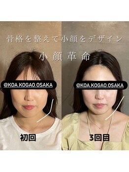 コア 心斎橋 堀江店(koa)/お客様ビフォーアフター