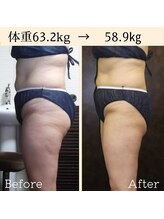 オレンジバナナ 長岡アクロスプラザ店/【美変身モニター】