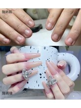 ザ デミュア 銀座店/施術変化→可愛いネイル