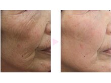 ノンノン(NonNon)/若々しい見た目へ