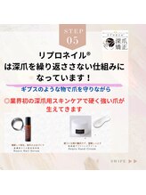 ブルームブルーム(BLOOMブルーム)/何故再発しないのか