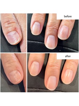 ケアプラス(care plus)/ハンドネイルケア