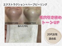 ミラ(Mira...)/☆Before→After☆
