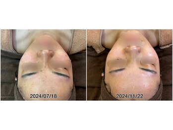 ドルフィン(Dolphin)/★お客様ビフォーアフター