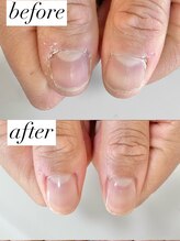 ニコワイズネイル(Nico Y's Nail)/【自爪育成コース】